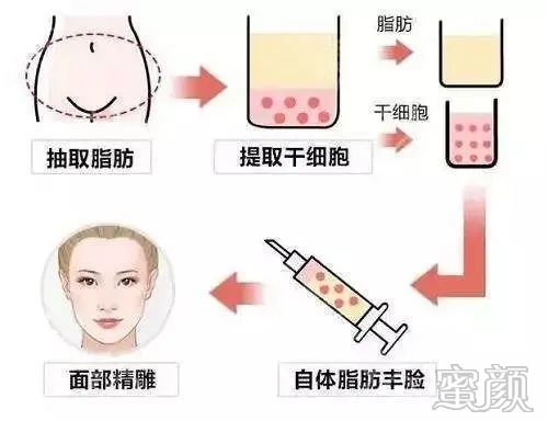 https://img.miyanlife.com/mnt/timg/200410/15404V203-3.jpg