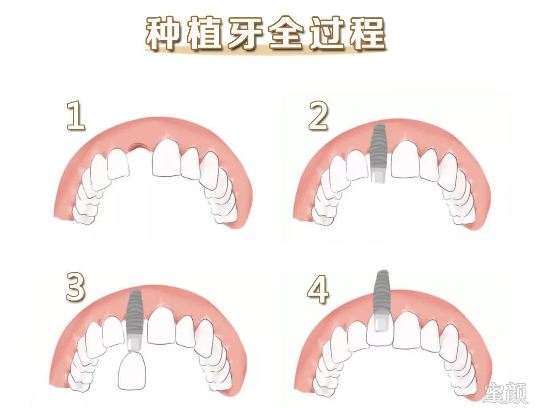 案例图片