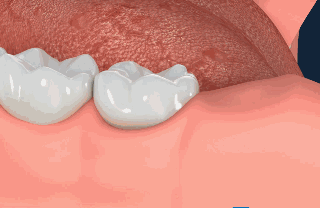 https://img.miyanlife.com/mnt/timg/200411/16335a9C-4.gif