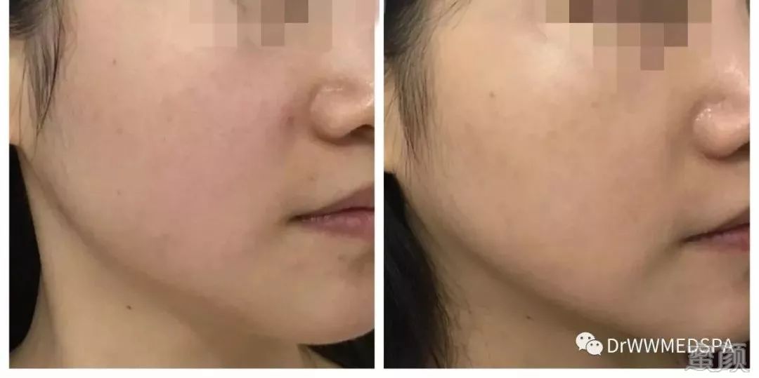 https://img.miyanlife.com/mnt/timg/200411/1643196012-4.jpg