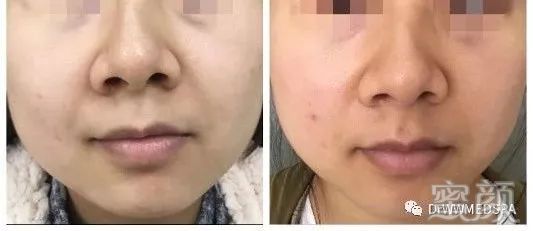 https://img.miyanlife.com/mnt/timg/200411/16431A291-0.jpg