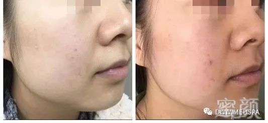 https://img.miyanlife.com/mnt/timg/200411/16431II6-1.jpg
