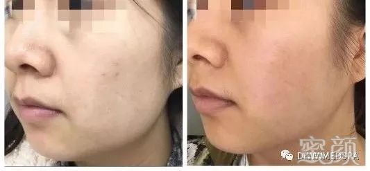 https://img.miyanlife.com/mnt/timg/200411/16431K105-2.jpg