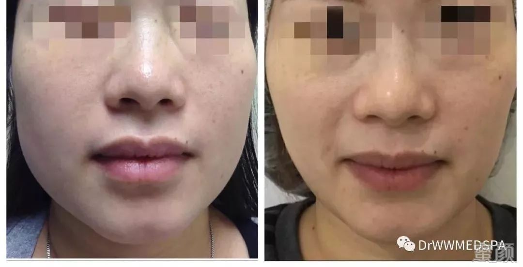 https://img.miyanlife.com/mnt/timg/200411/1643212V2-5.jpg