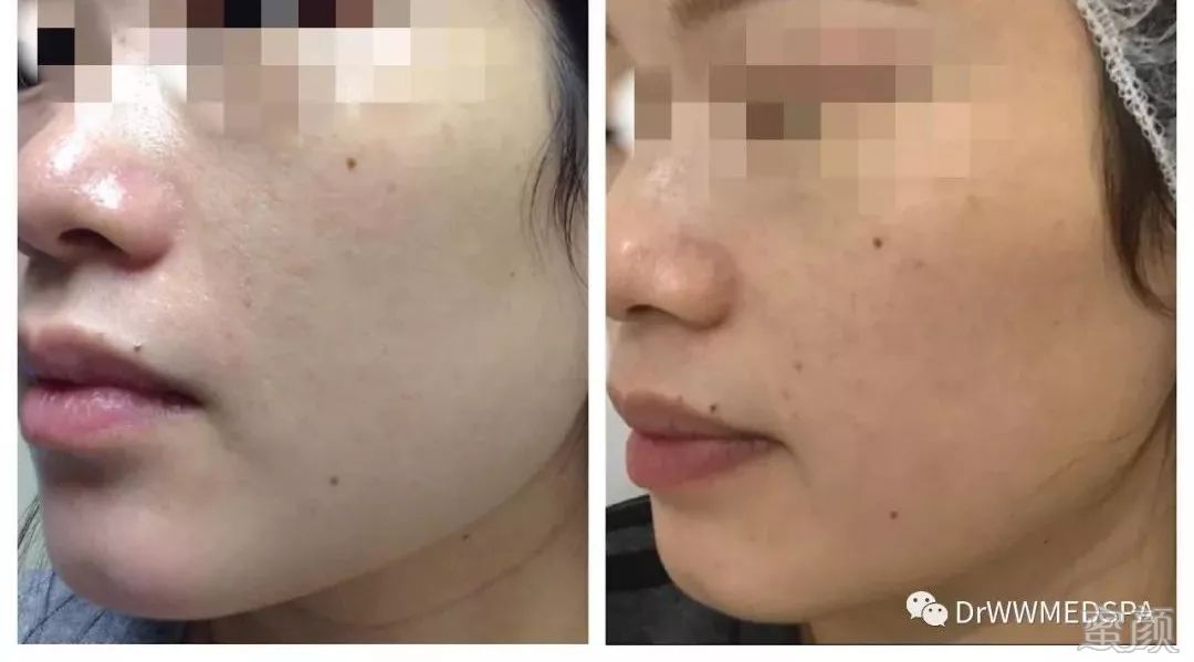 https://img.miyanlife.com/mnt/timg/200411/16432215M-6.jpg