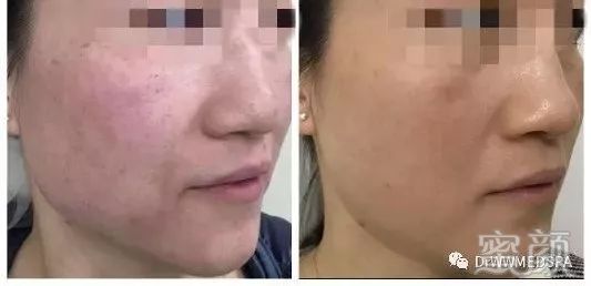 https://img.miyanlife.com/mnt/timg/200411/1643262B3-10.jpg