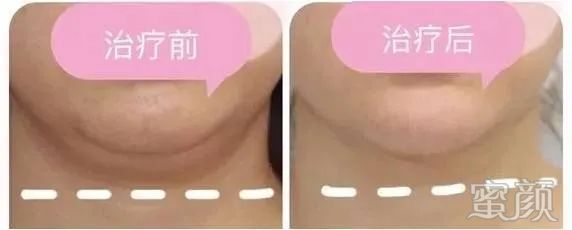 https://img.miyanlife.com/mnt/timg/200411/1S2593157-4.jpg