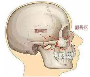 案例图片