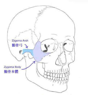 案例图片