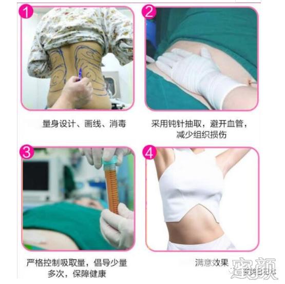 https://img.miyanlife.com/mnt/timg/200411/1U3396011-3.jpg