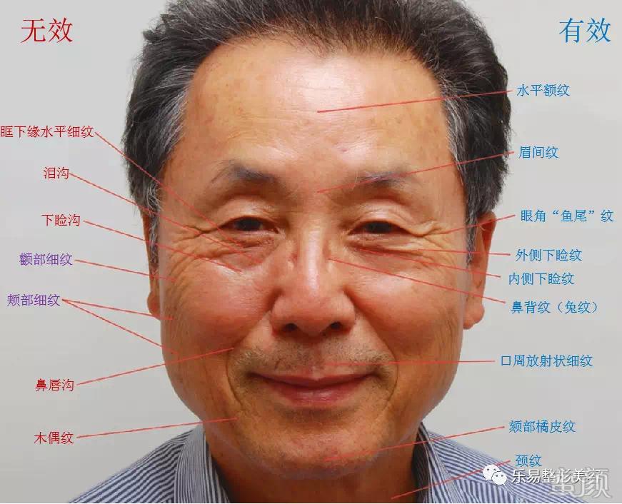 https://img.miyanlife.com/mnt/timg/200413/14501aP5-3.jpg