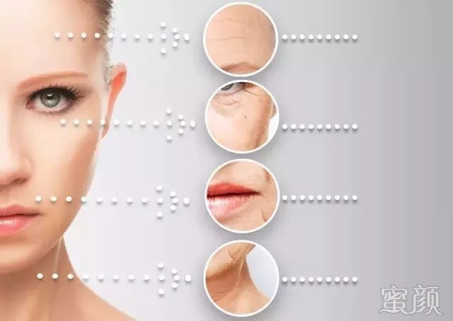 https://img.miyanlife.com/mnt/timg/200413/15132W518-3.jpg