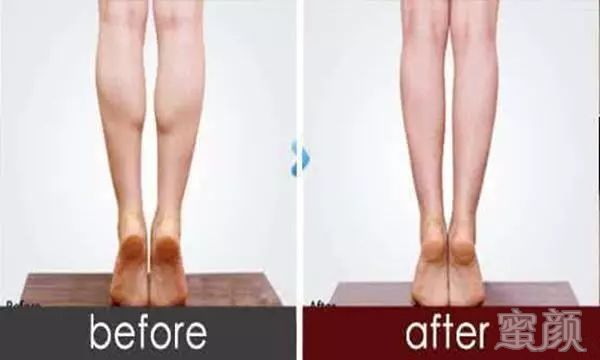 https://img.miyanlife.com/mnt/timg/200413/151331NK-9.jpg