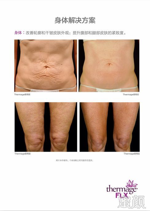 https://img.miyanlife.com/mnt/timg/200414/141A01151-5.jpg