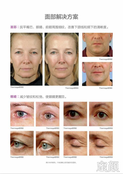 https://img.miyanlife.com/mnt/timg/200414/141A05235-4.jpg
