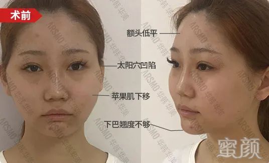 https://img.miyanlife.com/mnt/timg/200415/134H640T-2.jpg
