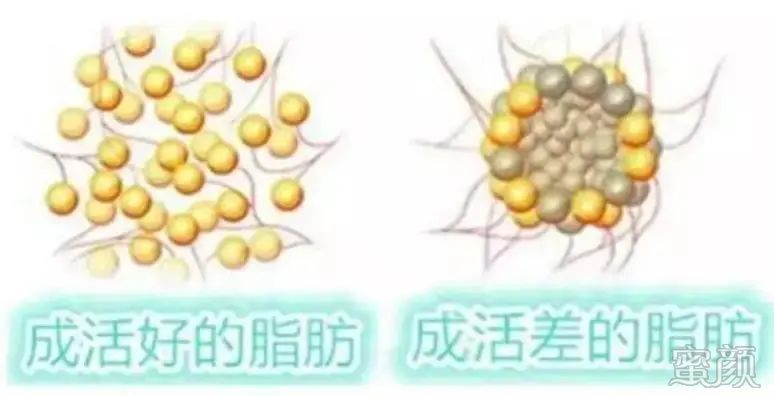 https://img.miyanlife.com/mnt/timg/200415/134IJ3O-14.jpg