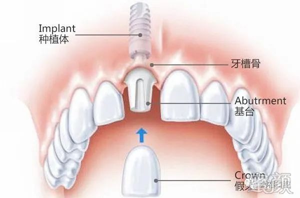 https://img.miyanlife.com/mnt/timg/200415/1415325b7-2.jpg