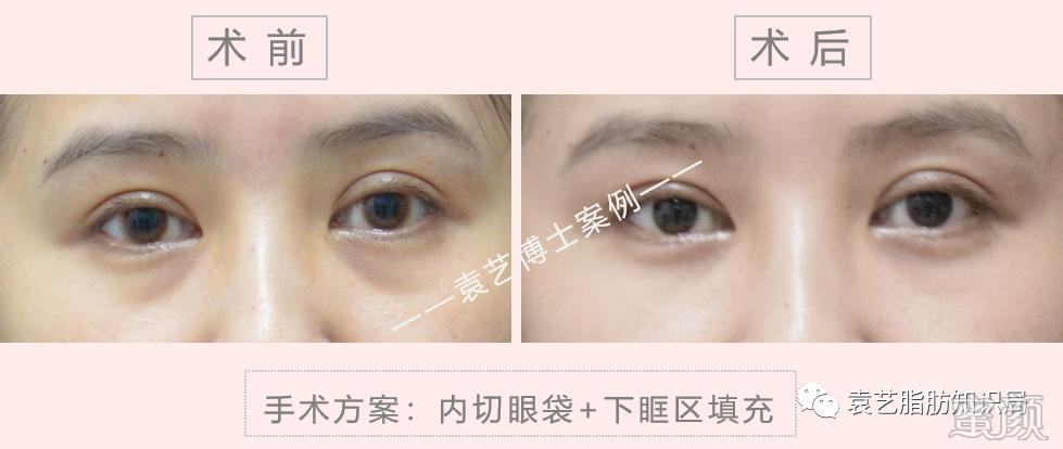 https://img.miyanlife.com/mnt/timg/200415/1514193S7-17.jpg