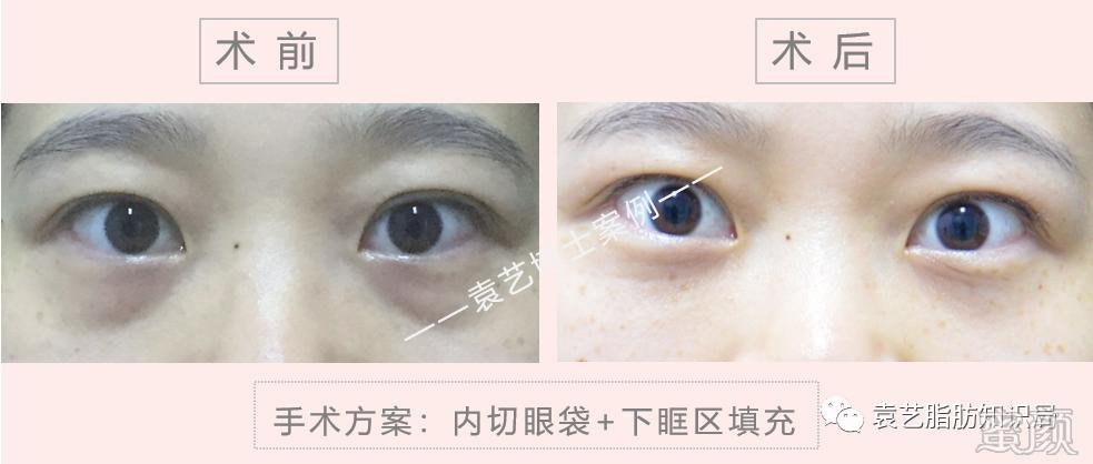 https://img.miyanlife.com/mnt/timg/200415/15142aX7-18.jpg