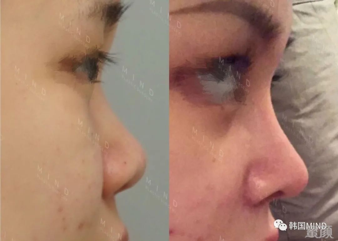 https://img.miyanlife.com/mnt/timg/200415/1535493117-5.jpg