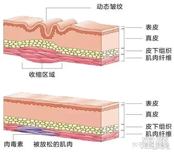 https://img.miyanlife.com/mnt/timg/200416/150IM553-5.jpg