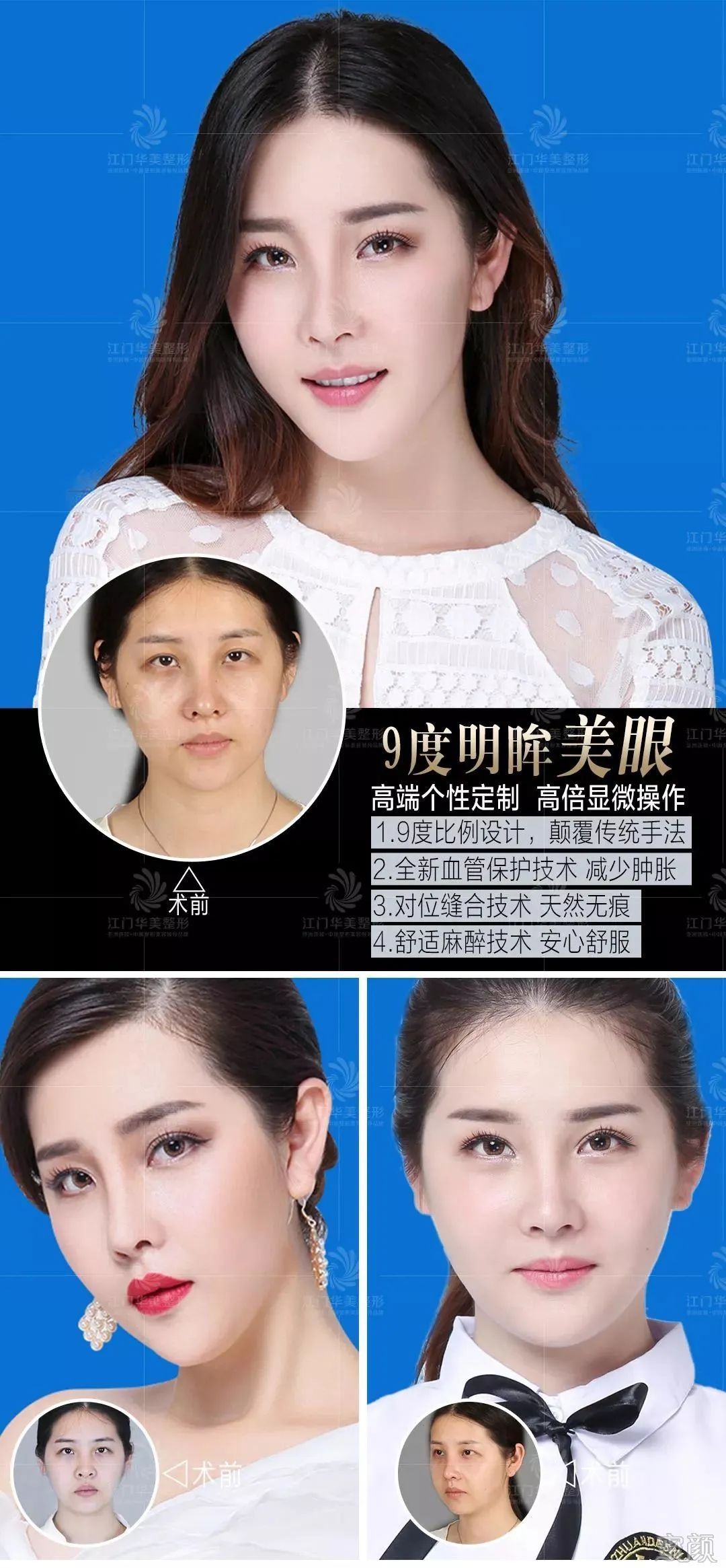 https://img.miyanlife.com/mnt/timg/200416/15400KB9-8.jpg