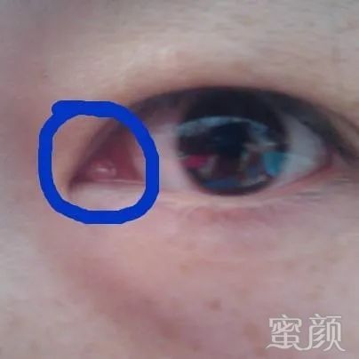 https://img.miyanlife.com/mnt/timg/200416/15525630I-3.jpg