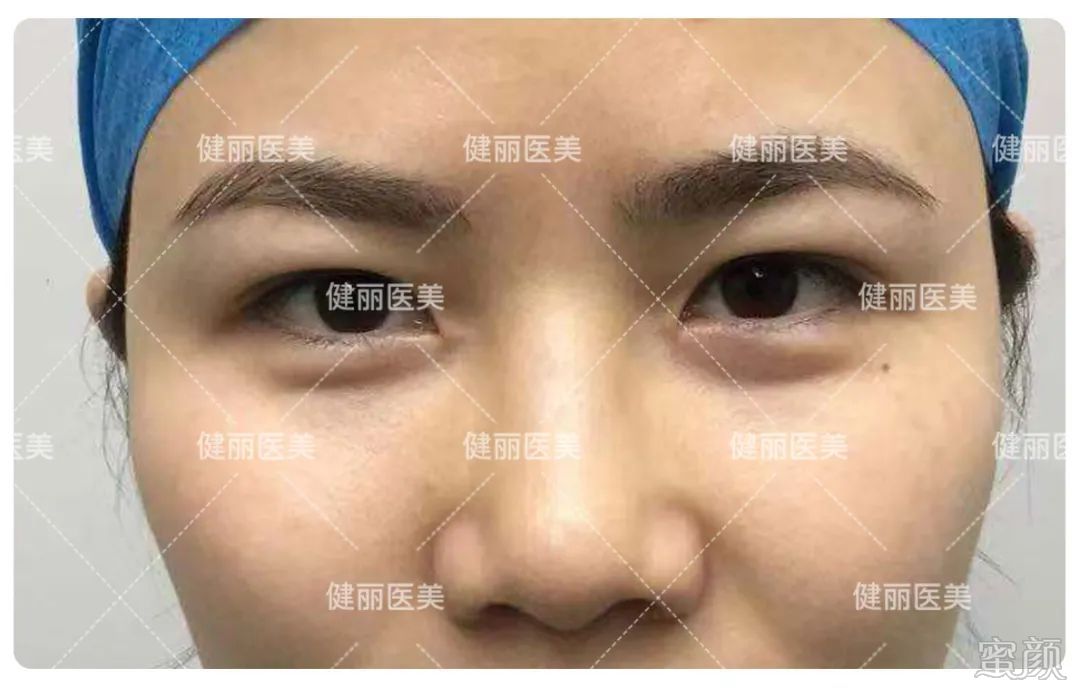 https://img.miyanlife.com/mnt/timg/200416/155300JX-7.jpg