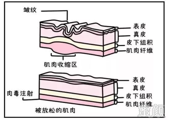 https://img.miyanlife.com/mnt/timg/200416/1554594359-3.jpg