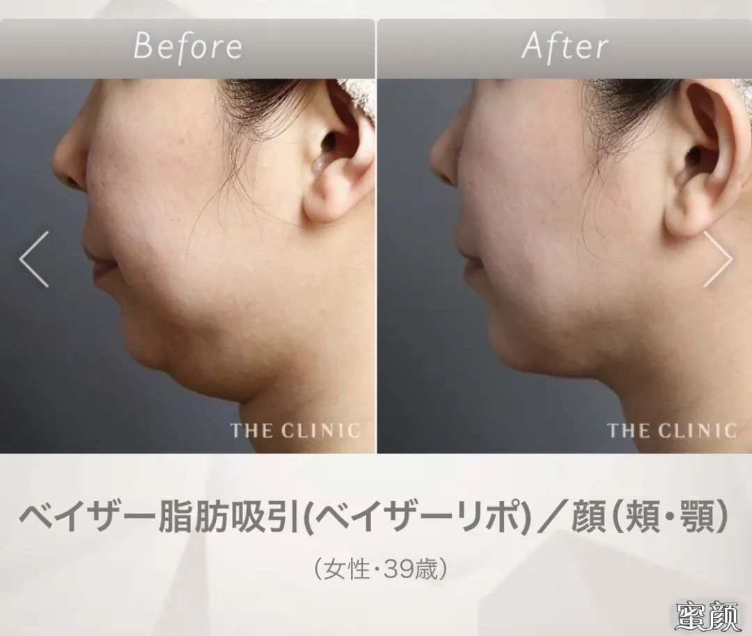https://img.miyanlife.com/mnt/timg/200417/1333412050-1.jpg