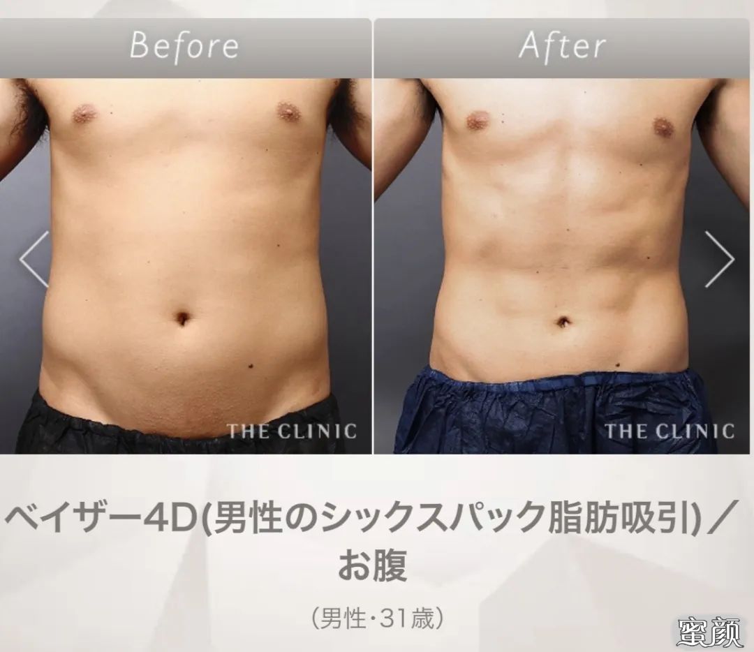 https://img.miyanlife.com/mnt/timg/200417/1333441039-3.jpg