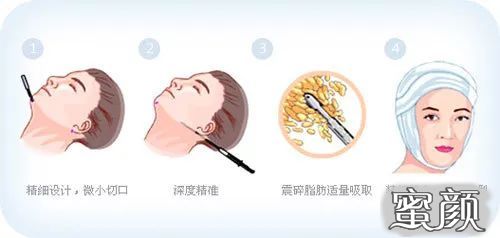 https://img.miyanlife.com/mnt/timg/200417/133450A41-3.jpg