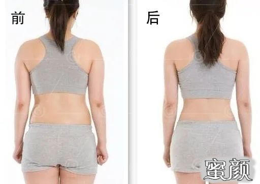 https://img.miyanlife.com/mnt/timg/200417/133G444I-10.jpg