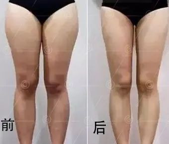 https://img.miyanlife.com/mnt/timg/200417/133G4O36-11.jpg