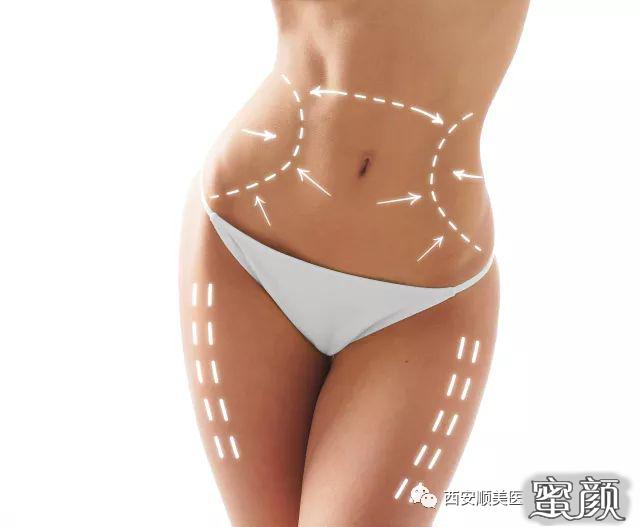 https://img.miyanlife.com/mnt/timg/200417/1342452U5-5.jpg