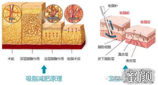 https://img.miyanlife.com/mnt/timg/200417/134251K26-8.jpg