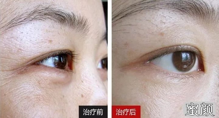 https://img.miyanlife.com/mnt/timg/200417/134950G41-6.jpg