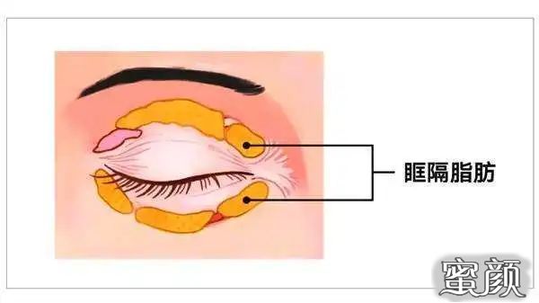https://img.miyanlife.com/mnt/timg/200417/135922NL-2.jpg