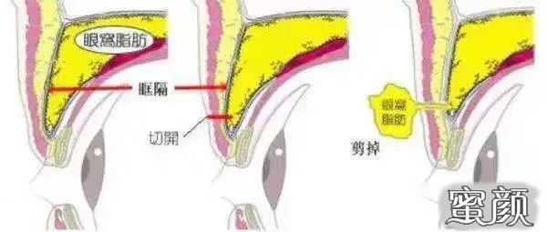 https://img.miyanlife.com/mnt/timg/200417/1359234P8-3.jpg
