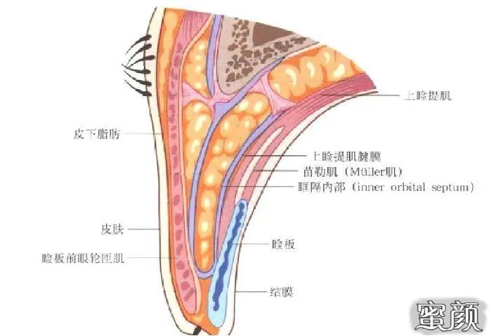 https://img.miyanlife.com/mnt/timg/200417/13593220F-13.jpg