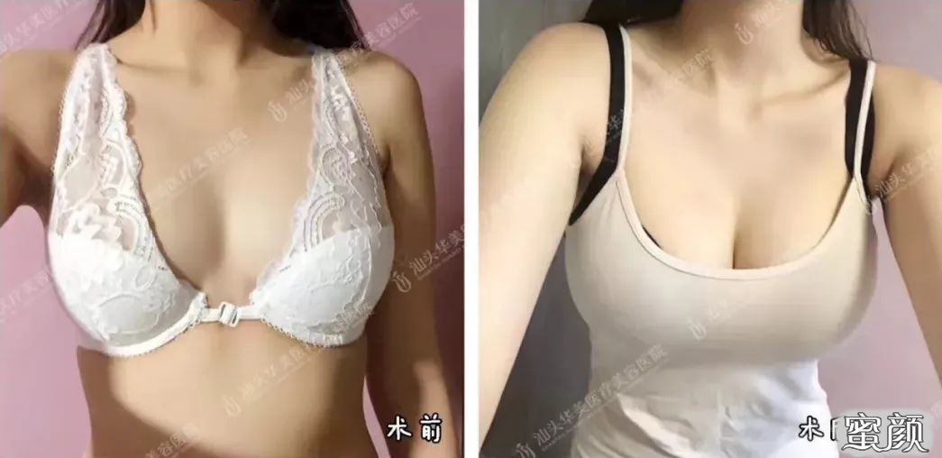 https://img.miyanlife.com/mnt/timg/200417/14291J400-5.jpg