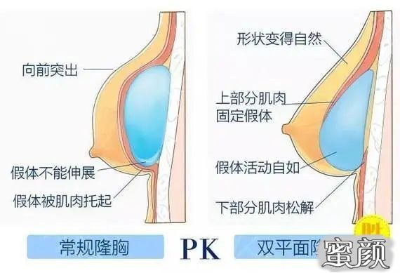 https://img.miyanlife.com/mnt/timg/200417/1429261F1-9.jpg