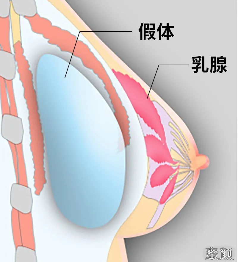 https://img.miyanlife.com/mnt/timg/200417/14292I0N-10.jpg