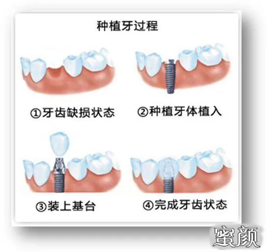 案例图片