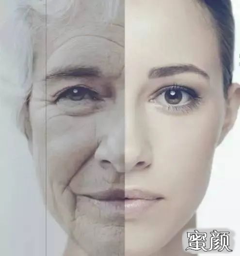 https://img.miyanlife.com/mnt/timg/200418/1314303416-0.jpg