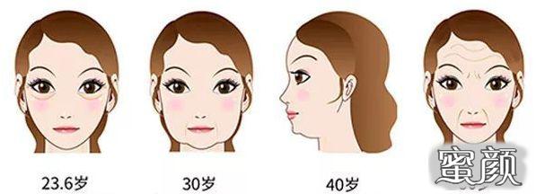 https://img.miyanlife.com/mnt/timg/200418/1314345562-2.jpg