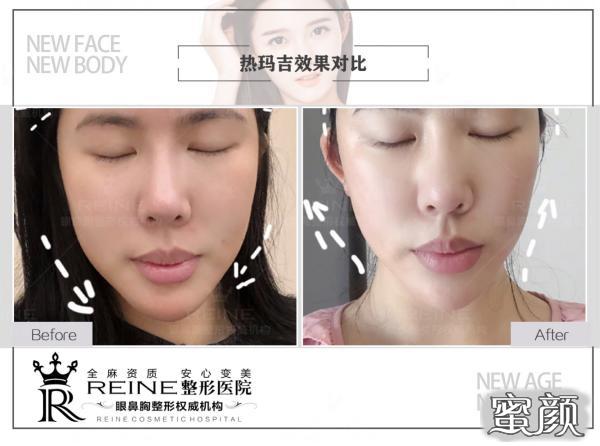 https://img.miyanlife.com/mnt/timg/200418/13144V406-6.jpg