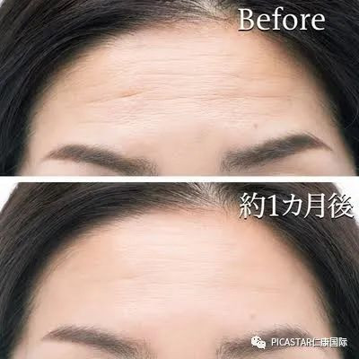 https://img.miyanlife.com/mnt/timg/200418/1316494A3-8.jpg