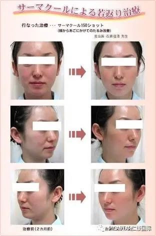 https://img.miyanlife.com/mnt/timg/200418/13164H538-3.jpg